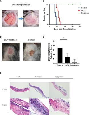 The Protective Effect of the Soluble Egg Antigen of Schistosoma japonicum in A Mouse Skin Transplantation Model